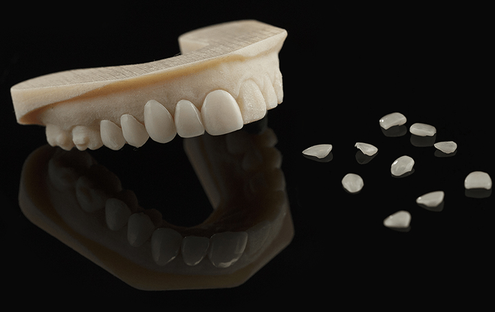 Prótese Dental Digital
