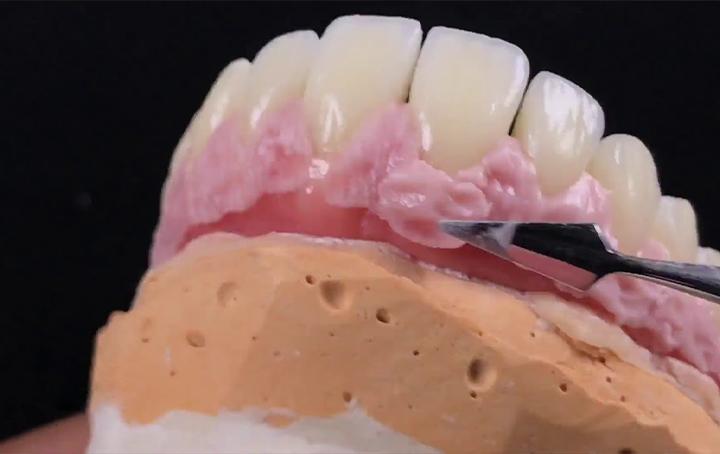 Protocolo Cerâmico